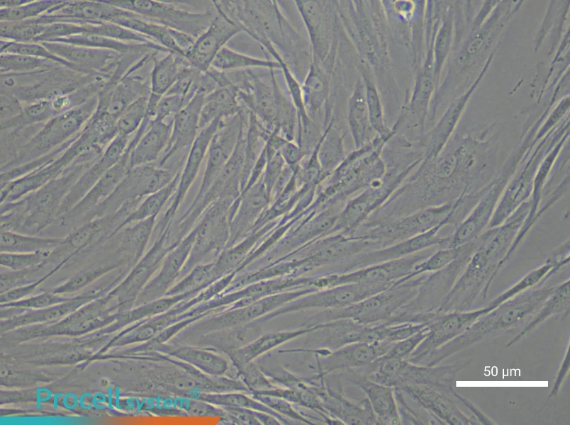 Human Endometrial Stromal Cell Complete Medium - 6