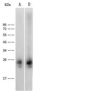 Recombinant IL36B/IL1F8 Monoclonal Antibody-searchlist-1