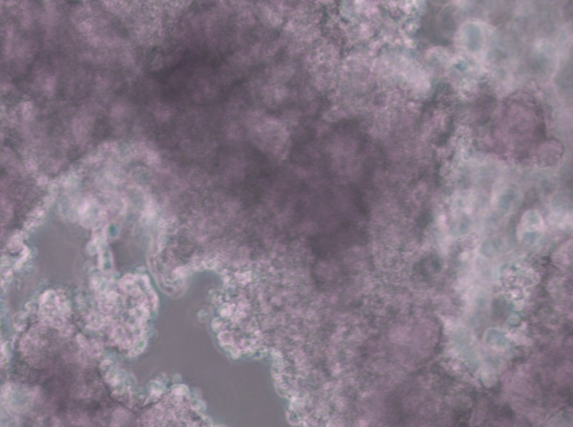 NCI-H660 Cell Complete Medium - 4