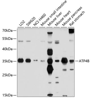 Western blot analysis of extracts of various cell lines using ATP4B Polyclonal Antibody at 1:1000 dilution.