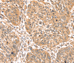 PDLIM4 Polyclonal Antibody - 3