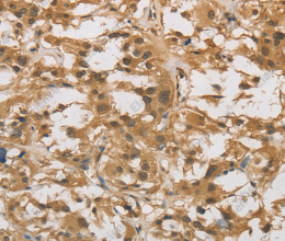 DAB2 Polyclonal Antibody - 3