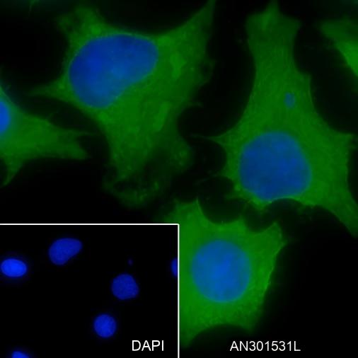 Recombinant GLUD1 Monoclonal Antibody - small - 3