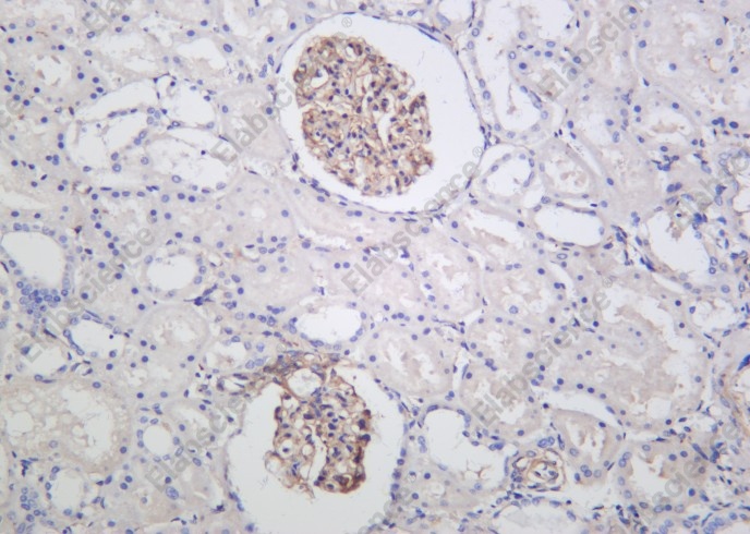 Recombinant ILK Monoclonal Antibody - 2