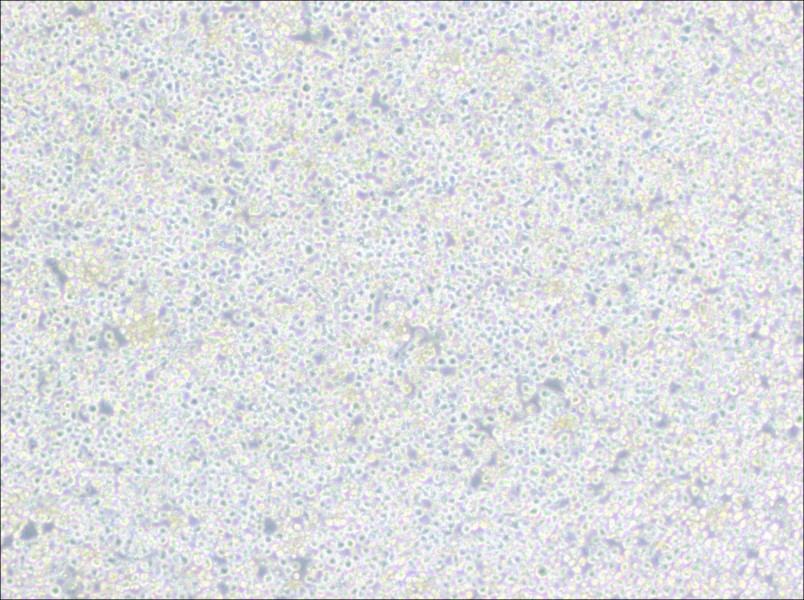 PC 61 5.3 [PC 61; PC 61.5.3] Cell Complete Medium - 3