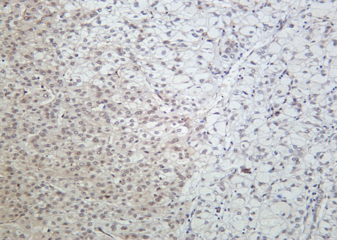 Recombinant CUL4A/B Monoclonal Antibody - small - 2