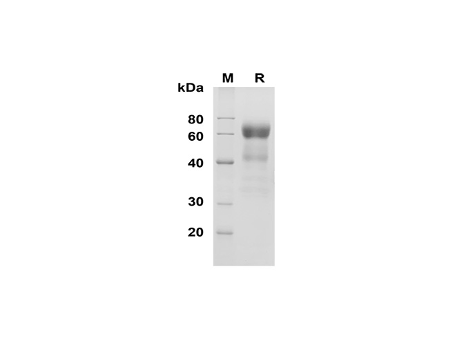 Recombinant Human GP4/CD36 Protein(His Tag)-产品推荐-1
