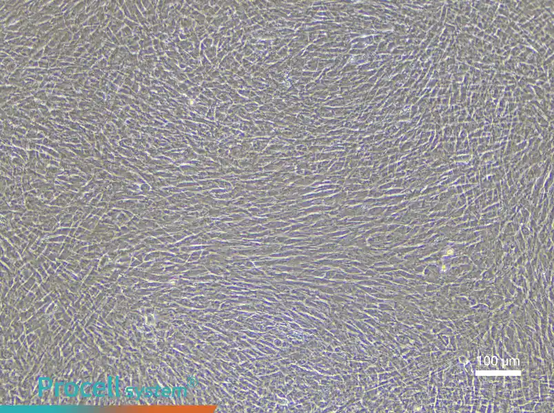Rabbit Pulmonary Great Artery Smooth Muscle Cell Complete Medium - 2