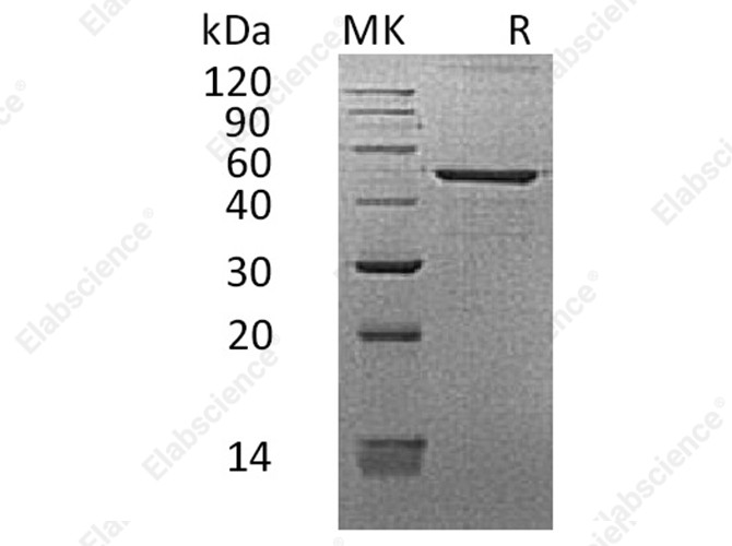 Recombinant Human REG3G/PAP-1B Protein (Fc Tag) - 1
