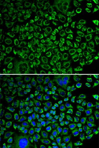 Immunofluorescence analysis of A549 cells using F10 Polyclonal Antibody