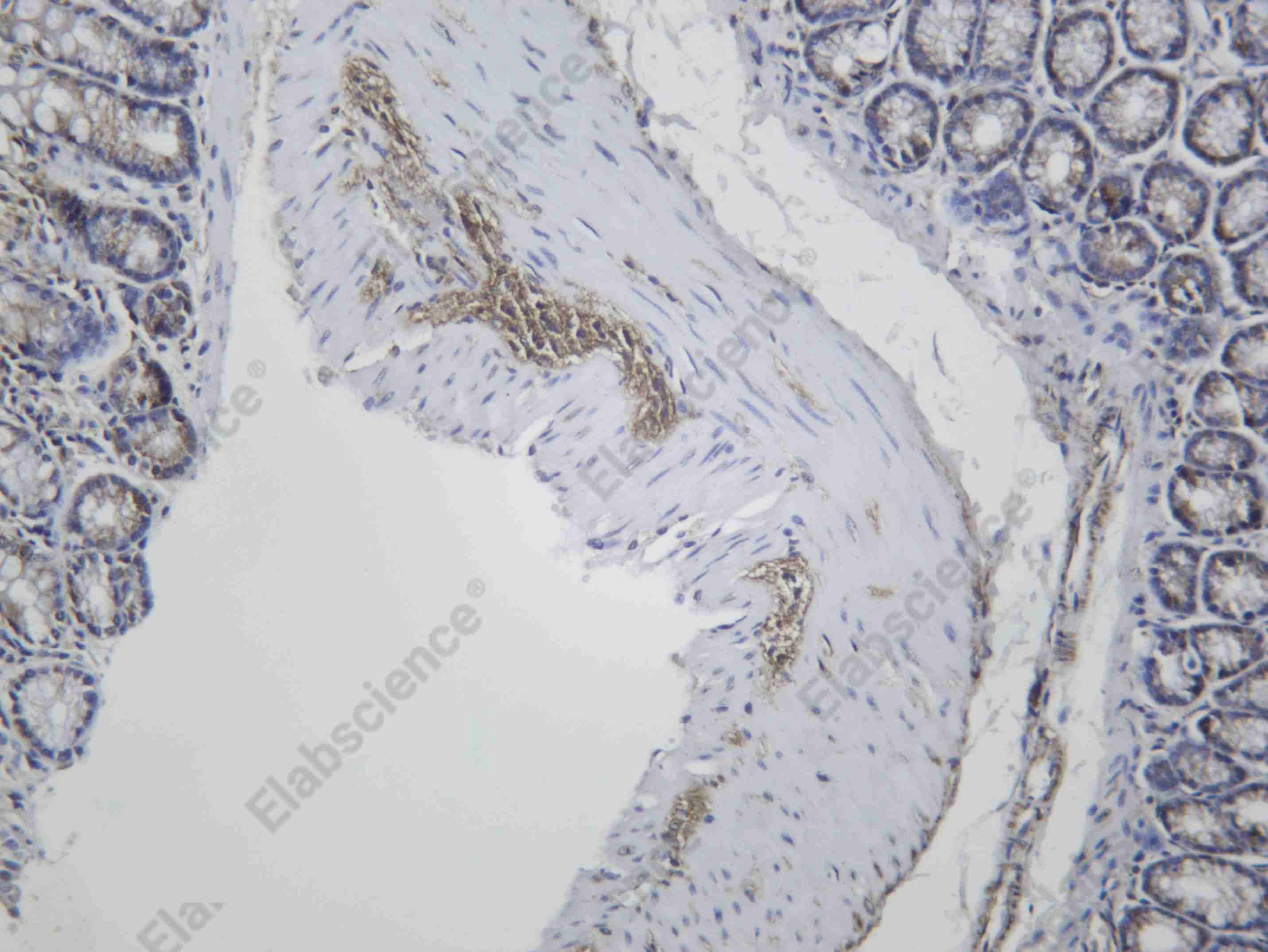 Recombinant Muscarinic Acetylcholine Receptor M2 Monoclonal Antibody - 2