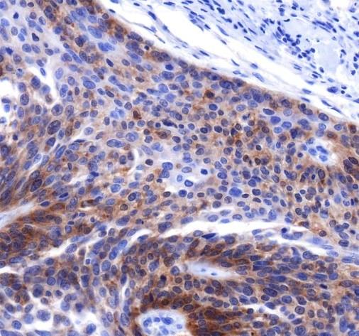 Recombinant HER4/ErbB4 Monoclonal Antibody - 2