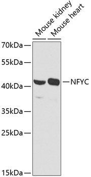 Western blot analysis of extracts of various cell lines using NFYC Polyclonal Antibody at dilution of 1:1000.