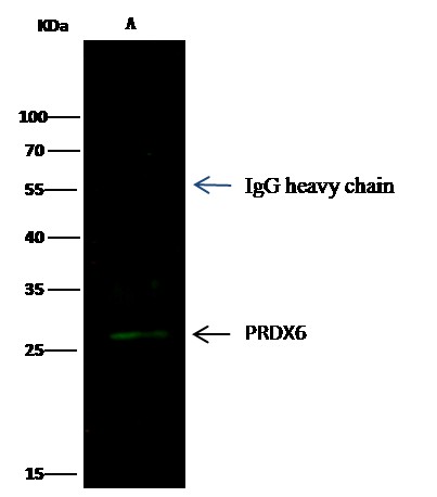 Peroxiredoxin 6/PRDX6 Monoclonal Antibody - small - 2