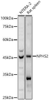 Western blot analysis of various lysates using NPHS2 Polyclonal Antibody at 1:1000 dilution.