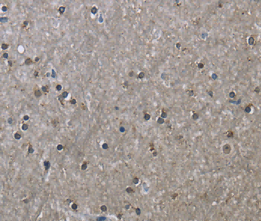 HSPA9 Polyclonal Antibody - 2