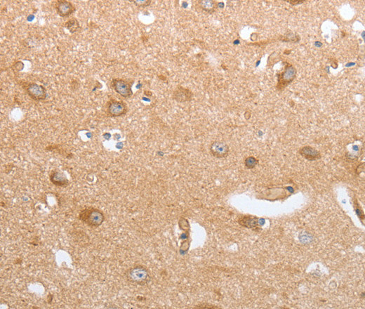 Immunohistochemistry of paraffin-embedded Human brain tissue using CASP12 Polyclonal Antibody at dilution 1:50