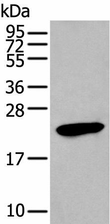 Western blot analysis of Human stomach tissue lysate  using GKN1 Polyclonal Antibody at dilution of 1:250