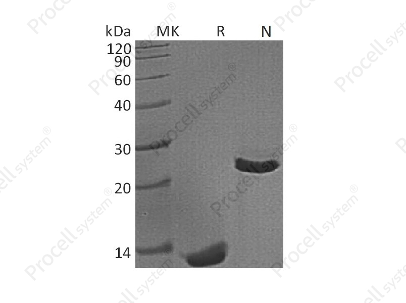TGF&beta;1/TGFB1, Mouse, Recombinant