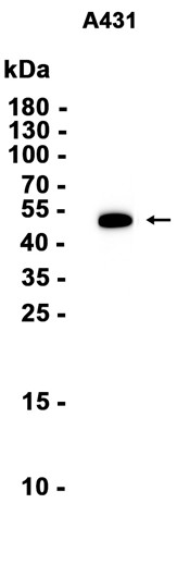 Recombinant KRT14/Cytokeratin 14 Monoclonal Antibody - 1