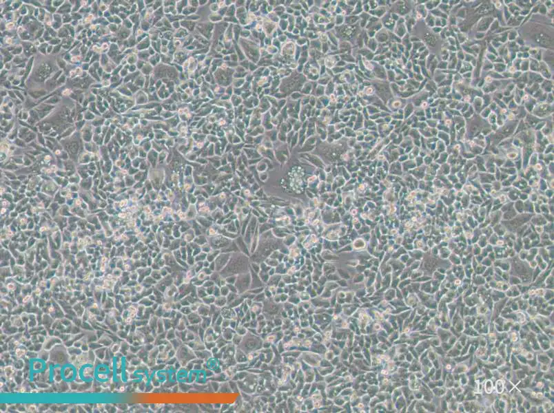 HCT-15-TAX Cell Complete Medium - 1