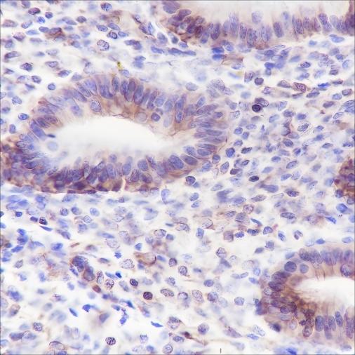 Recombinant ALOX15 Monoclonal Antibody - 2