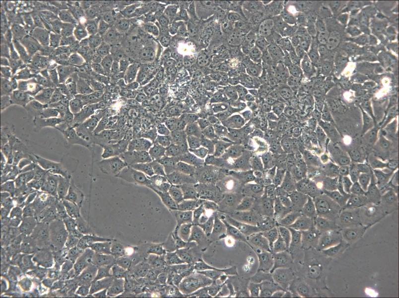 KYSE-140 Cell Complete Medium - 4