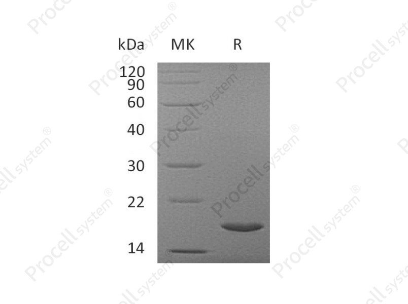 IL-37/IL-1F7/IL-1H4, Human, Recombinant