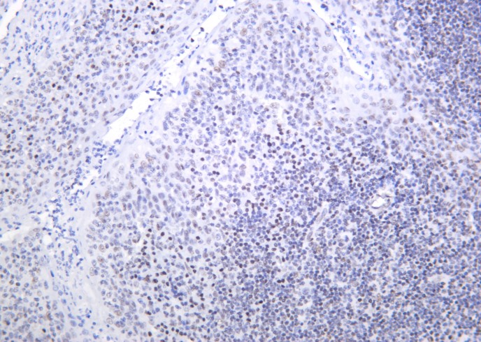 Recombinant Bmi-1 Monoclonal Antibody-searchlist-1