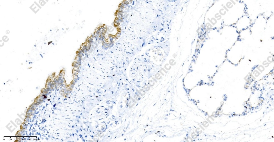 Recombinant Cytokeratin 19 Monoclonal Antibody - 2