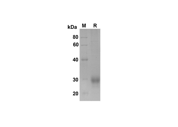 Recombinant Rat IL-10 Protein(Trx Tag)-产品推荐-1