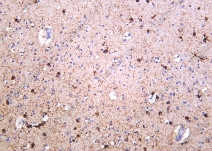 Recombinant NMDAR1 Monoclonal Antibody - 1