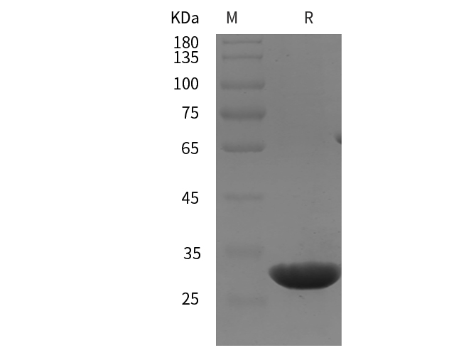 Recombinant Rat CD146/MCAM Protein(His Tag)-1