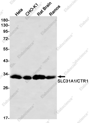 Recombinant SLC31A1 Monoclonal Antibody - 1