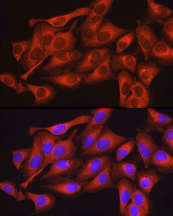 Immunofluorescence analysis of U2OS cells using DNM2 Polyclonal Antibody at dilution of 1:150. Blue: DAPI for nuclear staining.