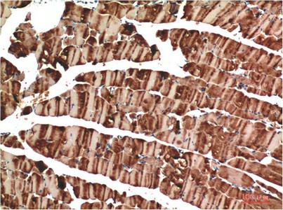 Immunohistochemistry of paraffin-embedded Mouse skeletal muscle tissue using ACTA1 Monoclonal Antibody at dilution of 1:200.