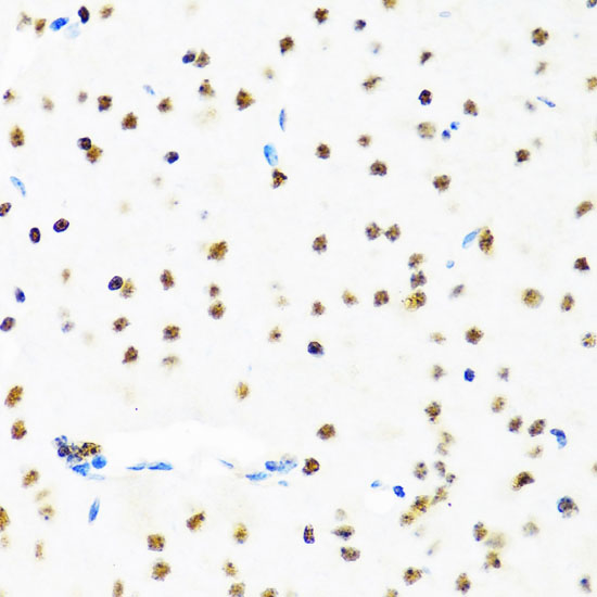 Immunohistochemistry of paraffin-embedded Mouse brain using SET Polyclonal Antibody at dilution of 1:100 (40x lens).