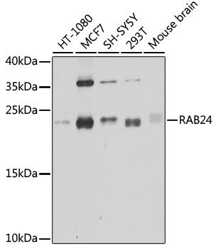 Western blot analysis of extracts of various cell lines using RAB24 Polyclonal Antibody at 1:1000 dilution.