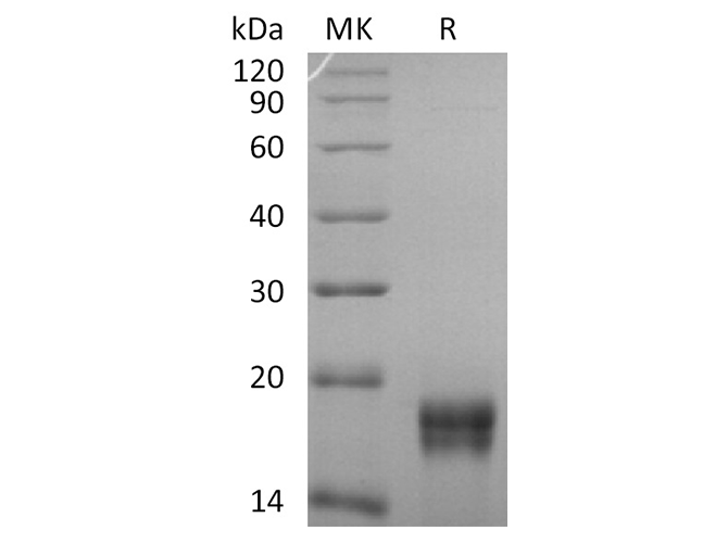 Recombinant Human GADD45beta/GADD45B Protein (His Tag)