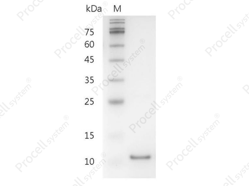 IL-5/EDF/BCDFII/TRF, Human, Recombinant