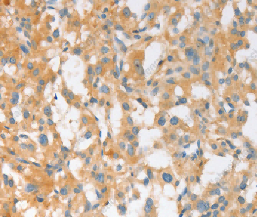 EPS15L1 Polyclonal Antibody - 2