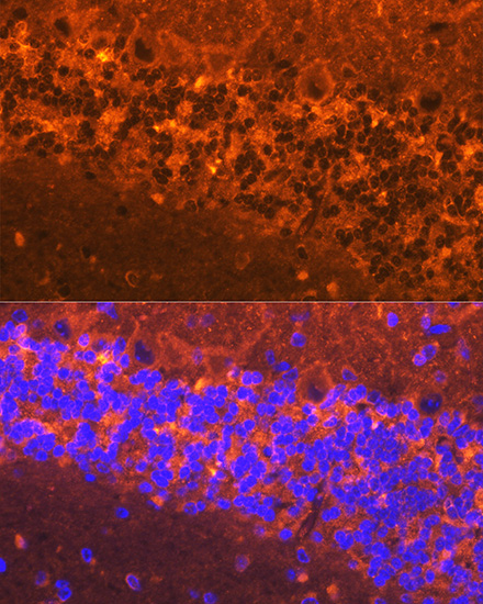 Immunofluorescence analysis of mouse brain using alpha-Synuclein Polyclonal Antibody at dilution of 1:100 (40x lens). Blue: DAPI for nuclear staining.