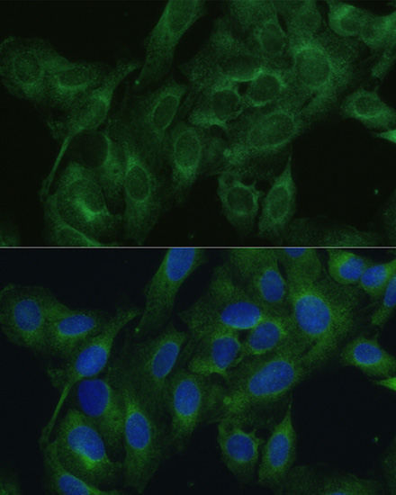 Immunofluorescence analysis of U2OS cells using FRMD6 Polyclonal Antibody at dilution of  1:100. Blue: DAPI for nuclear staining.