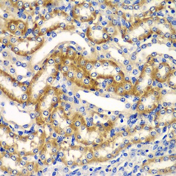 Immunohistochemistry of paraffin-embedded mouse kidney using ZFAND3 Polyclonal Antibody at dilution of 1:100 (40x lens).Perform microwave antigen retrieval with 10 mM PBS buffer pH 7.2 before commencing with IHC staining protocol.