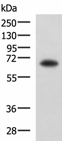 Western blot analysis of PC3 cell lysate  using SHC3 Polyclonal Antibody at dilution of 1:650