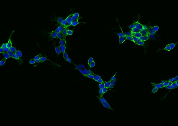 Recombinant NCAM Monoclonal Antibody-searchlist-1