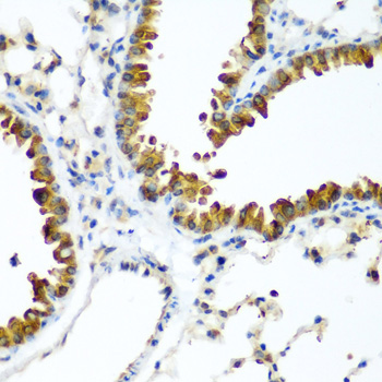 Immunohistochemistry of paraffin-embedded Mouse lung using TAZ Polyclonal Antibody at dilution of 1:200 (40x lens).