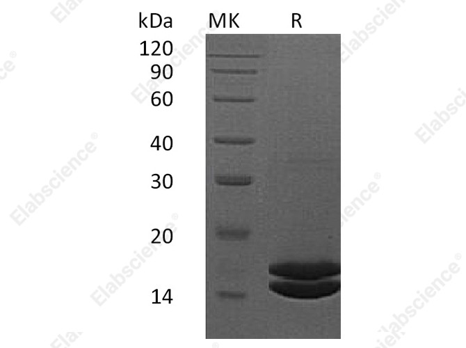 Recombinant Human Interleukin-2/IL-2 Protein (His Tag) - 1