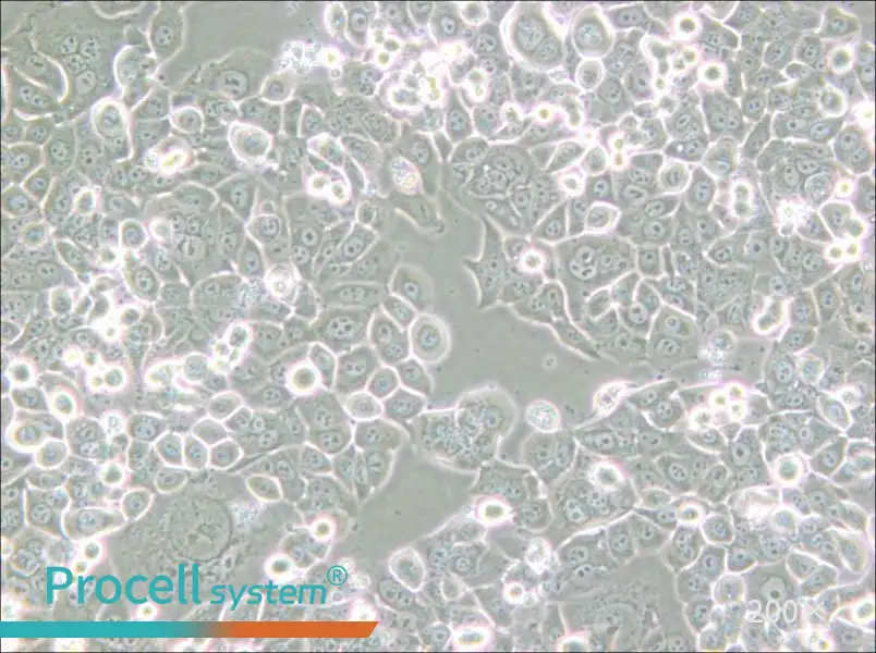 NCI-H2126 Cell Complete Medium - small - 6