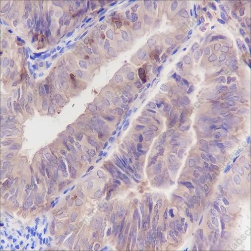 Recombinant ARPC5/p16 ARC Monoclonal Antibody - 3